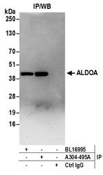 ALDOA Antibody in Immunoprecipitation (IP)