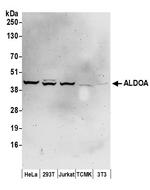 ALDOA Polyclonal Antibody