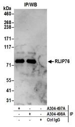 RLIP76 Polyclonal Antibody