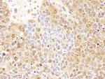 P23 Antibody in Immunohistochemistry (Paraffin) (IHC (P))