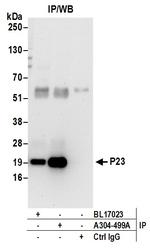 P23 Antibody in Immunoprecipitation (IP)
