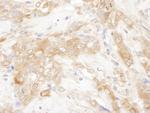 CHMP2B Polyclonal Antibody