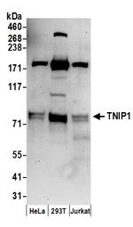 TNIP1 Polyclonal Antibody