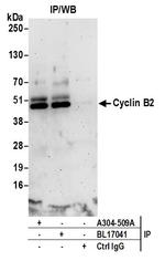 Cyclin B2 Antibody in Immunoprecipitation (IP)