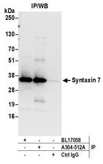 Syntaxin 7 Antibody in Immunoprecipitation (IP)