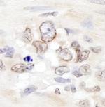 Aladin Polyclonal Antibody