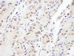 Aladin Antibody in Immunohistochemistry (Paraffin) (IHC (P))