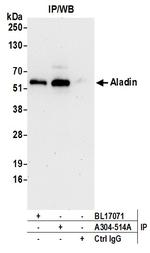 Aladin Antibody in Immunoprecipitation (IP)