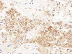ICLN Antibody in Immunohistochemistry (Paraffin) (IHC (P))