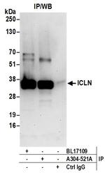 ICLN Antibody in Immunoprecipitation (IP)