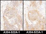 COPB2 Antibody in Immunohistochemistry (Paraffin) (IHC (P))