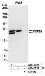 COPB2 Antibody in Immunoprecipitation (IP)