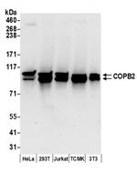 COPB2 Antibody in Western Blot (WB)