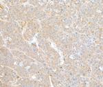 COPB2 Antibody in Immunohistochemistry (Paraffin) (IHC (P))