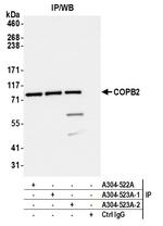 COPB2 Antibody in Immunoprecipitation (IP)