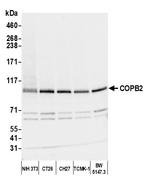 COPB2 Antibody in Western Blot (WB)