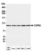 COPB2 Antibody in Western Blot (WB)