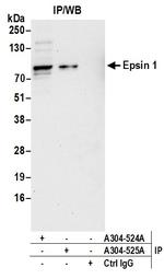 Epsin 1 Antibody in Immunoprecipitation (IP)