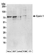 Epsin 1 Polyclonal Antibody