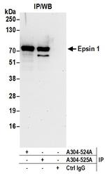 Epsin 1 Antibody in Immunoprecipitation (IP)