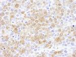 NUDC Antibody in Immunohistochemistry (Paraffin) (IHC (P))