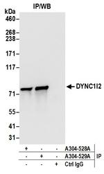 DYNC1I2 Antibody in Immunoprecipitation (IP)
