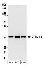 DYNC1I2 Antibody in Western Blot (WB)