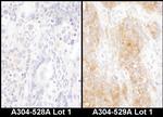 DYNC1I2 Antibody in Immunohistochemistry (Paraffin) (IHC (P))