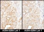 DYNC1I2 Polyclonal Antibody