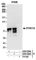 DYNC1I2 Antibody in Immunoprecipitation (IP)