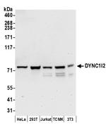 DYNC1I2 Antibody in Western Blot (WB)