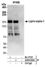 Liprin-alpha-1 Antibody in Immunoprecipitation (IP)