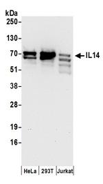 IL14 Antibody in Western Blot (WB)