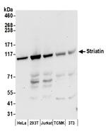 Striatin Polyclonal Antibody