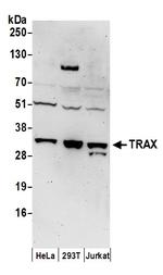 TRAX Antibody in Western Blot (WB)