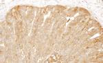 CAP1 Polyclonal Antibody