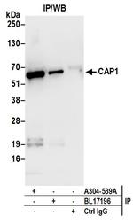 CAP1 Antibody in Immunoprecipitation (IP)