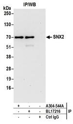 SNX2 Antibody in Immunoprecipitation (IP)
