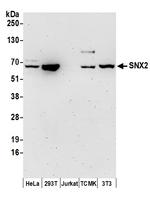 SNX2 Polyclonal Antibody