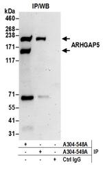 ARHGAP5 Antibody in Immunoprecipitation (IP)