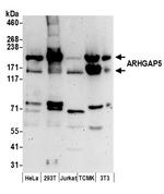 ARHGAP5 Antibody in Western Blot (WB)