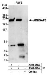ARHGAP5 Antibody in Immunoprecipitation (IP)