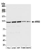 ARS2 Polyclonal Antibody