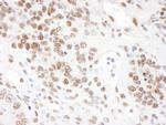 ARS2 Antibody in Immunohistochemistry (Paraffin) (IHC (P))