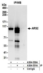 ARS2 Antibody in Immunoprecipitation (IP)