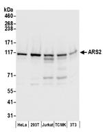 ARS2 Antibody in Western Blot (WB)