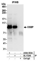 OSBP Polyclonal Antibody