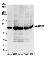 OSBP Polyclonal Antibody