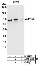 PGM3 Antibody in Immunoprecipitation (IP)