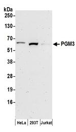 PGM3 Polyclonal Antibody